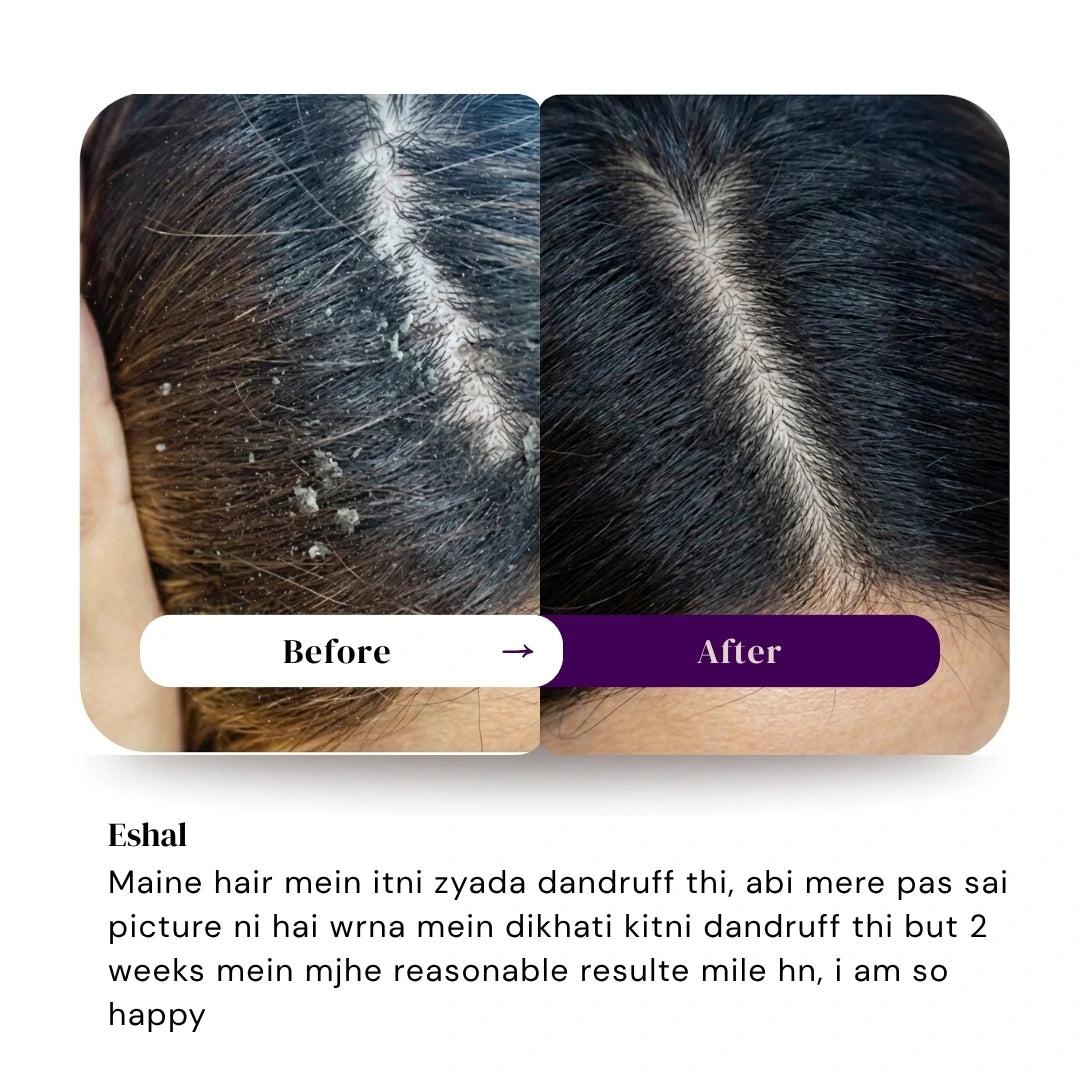 Magic Hair Growth Oil