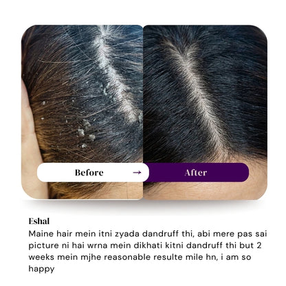 Magic Hair Growth Oil