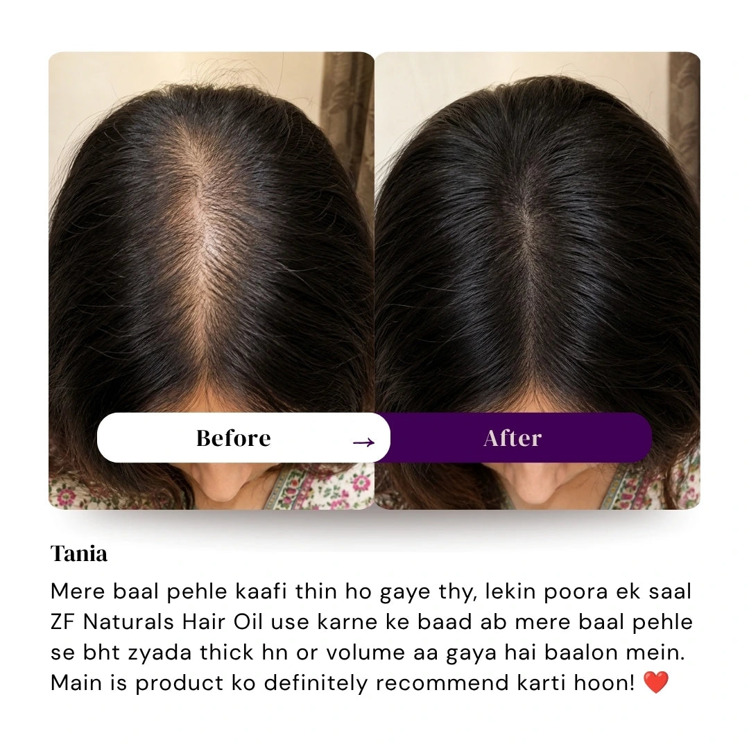 Magic Hair Growth Oil
