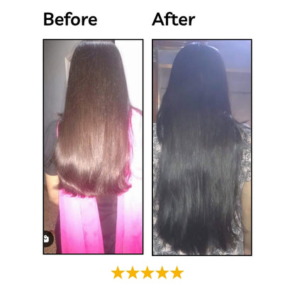 HAIRAAZ Hair Regrowth Serum