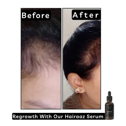 HAIRAAZ Hair Regrowth Serum