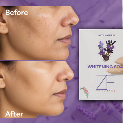 Goatmilk Whitening Soap