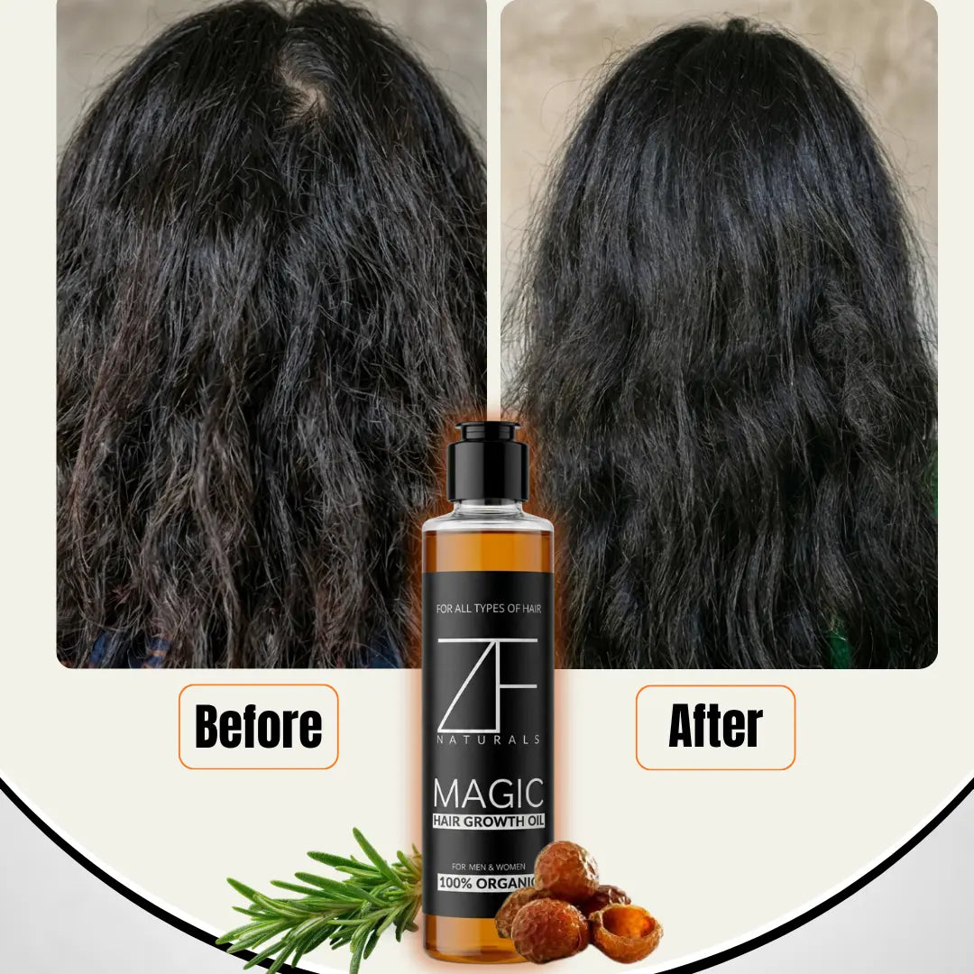 Magic Hair Growth Oil