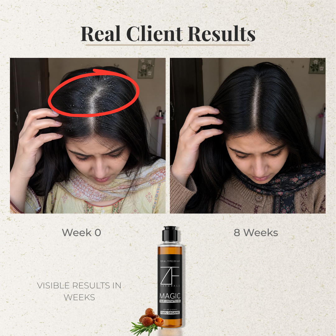 hair loss treatment oil for thinning hair and hair regrowth Pakistan
